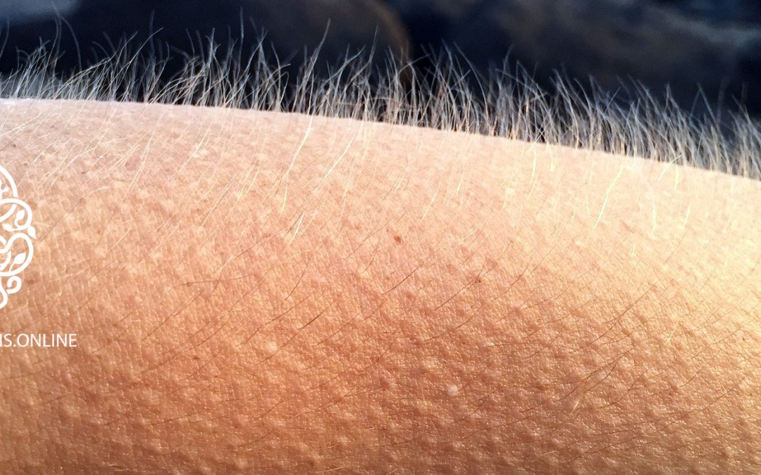 Goosebumps as an indicator of alignment